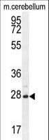 VSTM2A Antibody (aa97-126)