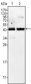 AMACR / P504S Antibody (clone 2A10F3)