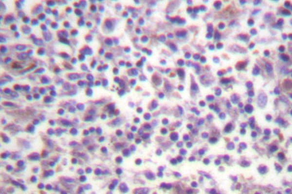 BRAF / B-Raf Antibody (Ala597)