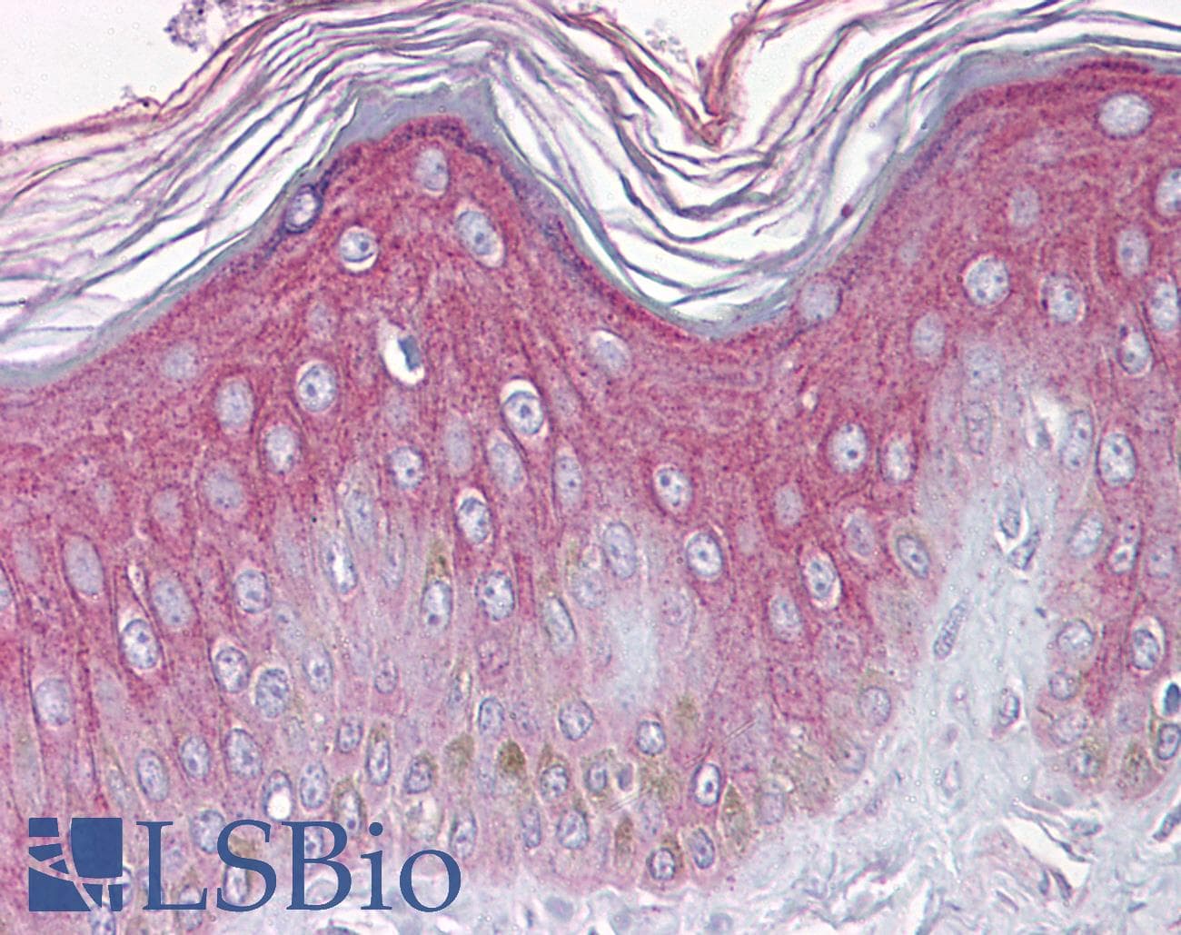 IHC-plus™ FGFR1 / FGF Receptor 1 Antibody (N-Terminus, clone M19B2)