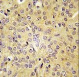 LARS / Leucyl-TRNA Synthetase Antibody (aa1118-1145)