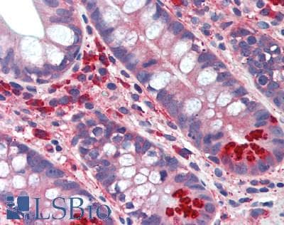 Polyclonal Rabbit anti-Mouse EPO / Erythropoietin Antibody (aa82-192, IHC, WB)