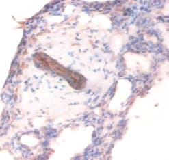 COL4A1 / Collagen IV Alpha1 Antibody