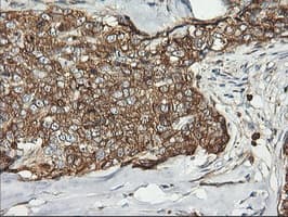 PFKP Antibody (clone OTI2F2, Carrier-free)