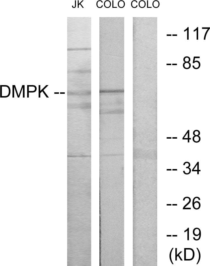 DMPK / DM Antibody