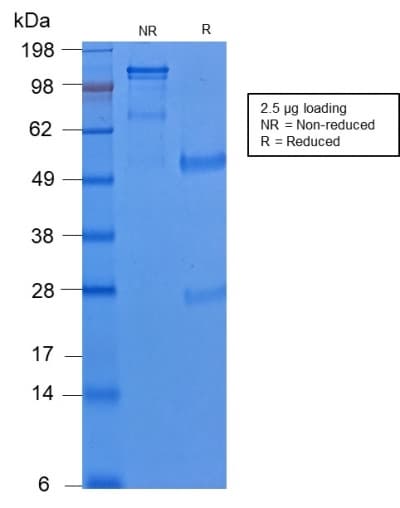 KRT8 / CK8 / Cytokeratin 8 Antibody (clone KRT8/2174R)