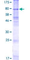 Human RHCG Protein (Recombinant GST)