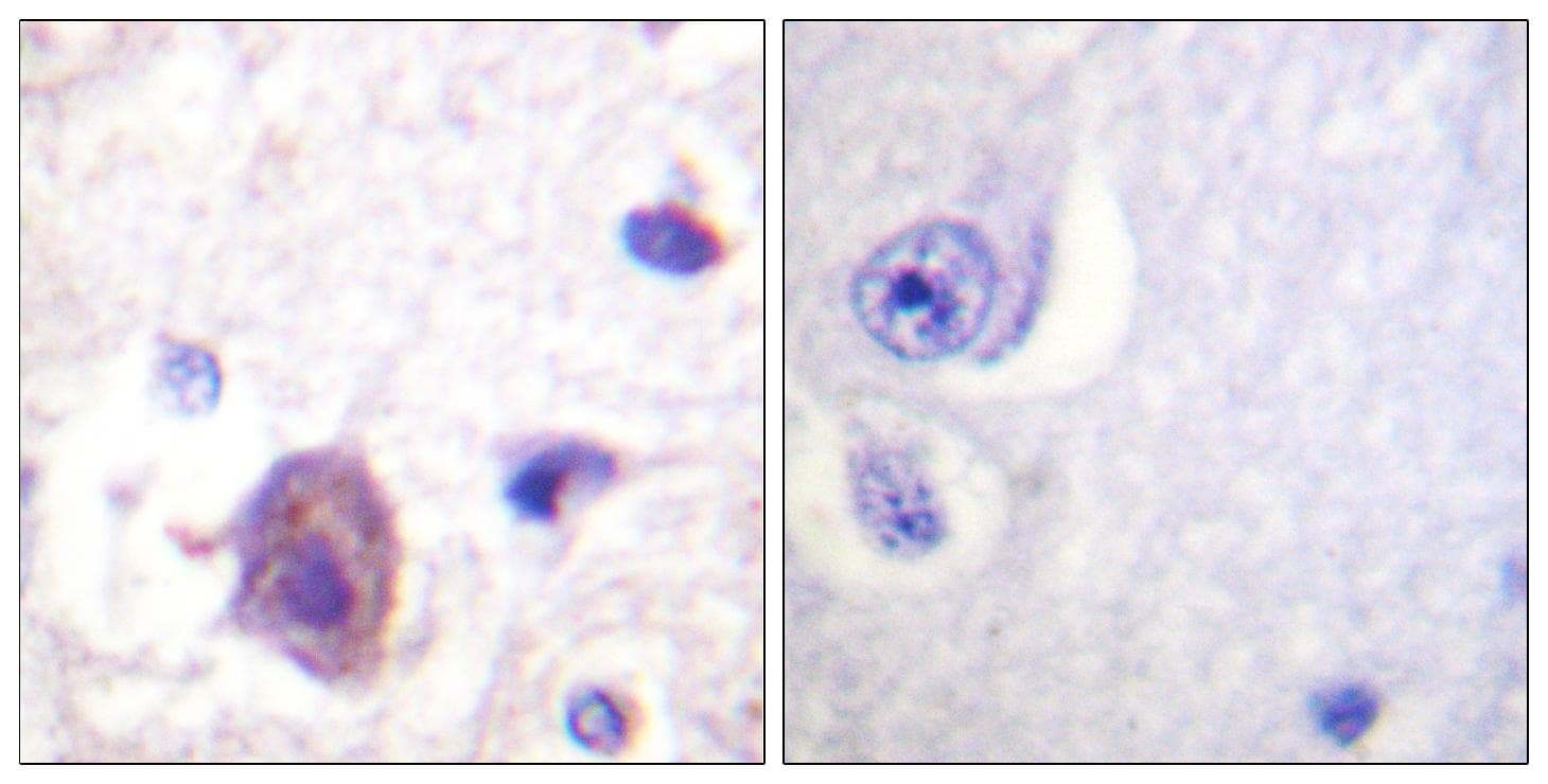 FAK / Focal Adhesion Kinase Antibody (phospho-Ser910)