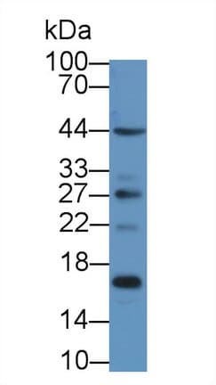 S100A16 Antibody (aa1-97, PE)