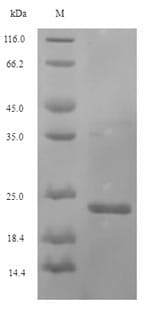 Legionella pneumophila pal Protein (Recombinant 6His-SUMO, N-terminus)
