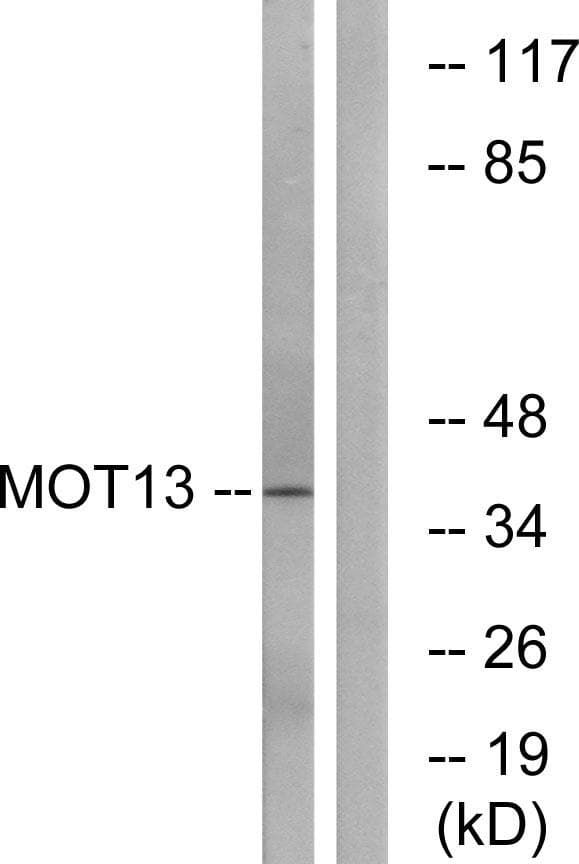 SLC16A13 Antibody