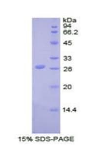 Bovine UCHL5 / UCH37 Protein (Recombinant His)