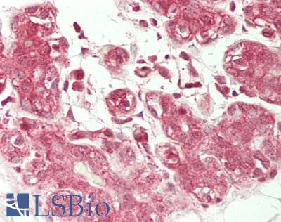 IHC-plus™ Polyclonal Rabbit anti-Human Calmodulin Antibody (aa 2-149, IHC)