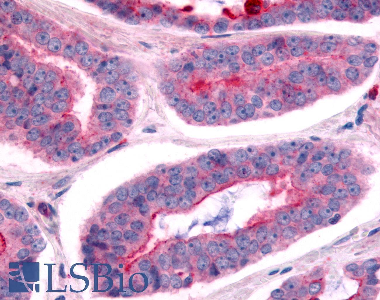 PathPlus™ NEK7 Antibody (Kinase Domain)