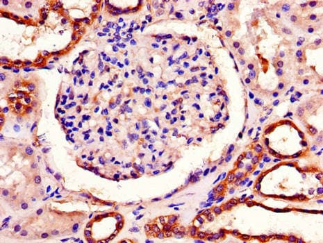 Polyclonal Rabbit anti-Human PITX3 Antibody (IHC, WB)