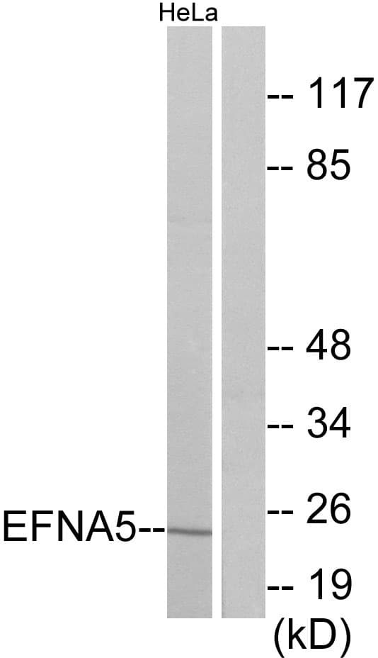 IHC-plus™ EFNA5 / Ephrin A5 Antibody (aa31-80)