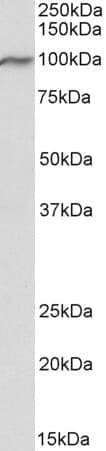 IHC-plus™ VPS16 Antibody (aa358-371)