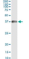 IHC-plus™ HADH Antibody (clone 4B5)