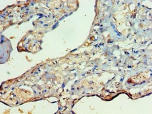 RIPK3 / RIP3 Antibody (aa1-120)