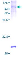 Human PDE4D Protein (Recombinant GST)
