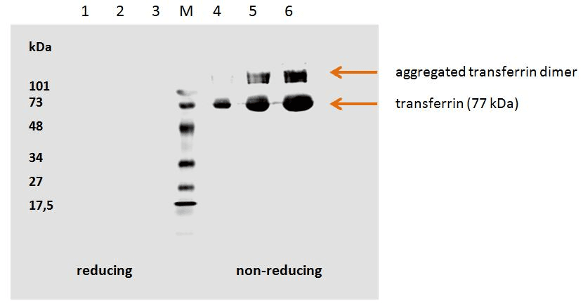 IHC-plus™ TF / Transferrin Antibody (clone HTF-14)