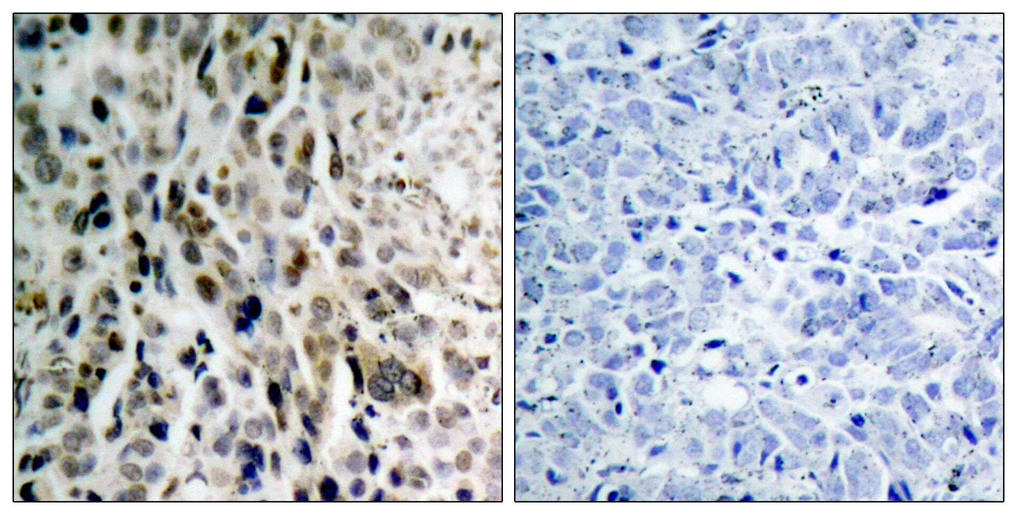 CHEK2 / CHK2 Antibody (phospho-Thr68)
