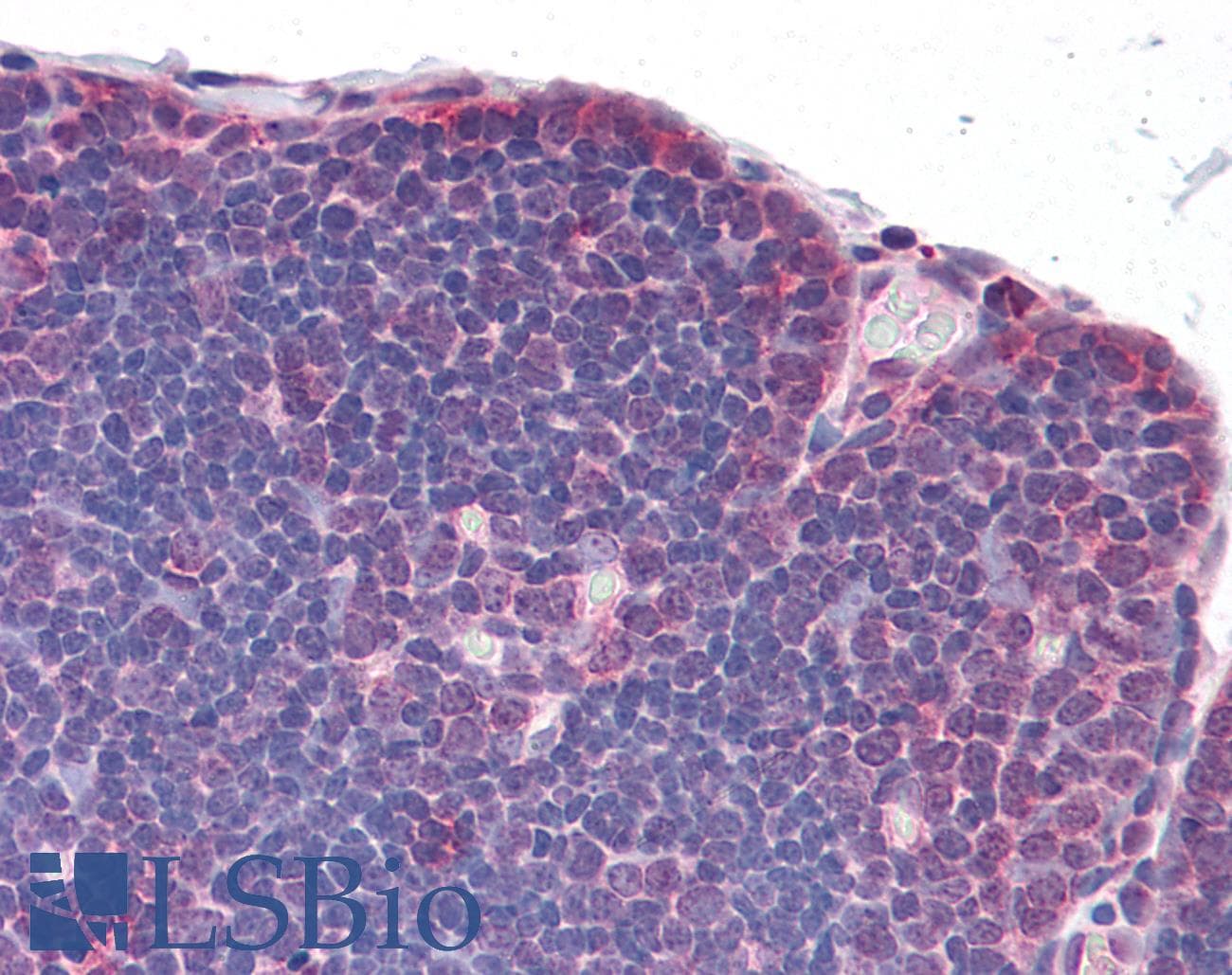 Polyclonal Rabbit anti-Human TLR8 Antibody (IHC)