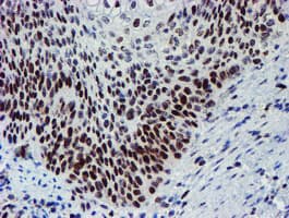 SNAI2 / SLUG Antibody (clone OTI1A6)