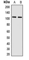 Polyclonal Rabbit anti-Human PCDHA13 Antibody (WB)