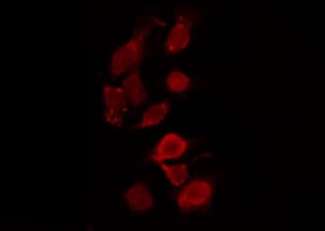 Polyclonal Rabbit anti-Human TOP2A / Topoisomerase II Alpha Antibody (IHC, IF, WB)