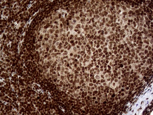 Monoclonal Mouse anti-Human MGMT Antibody (clone OTI6G6, Carrier-free, IHC, WB)