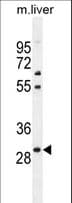 PHOX2B Antibody (aa104-130)