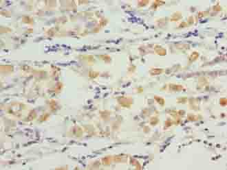 Polyclonal Rabbit anti-Human SMG6 Antibody (aa251-511, IHC)