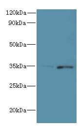 FYTTD1 Antibody