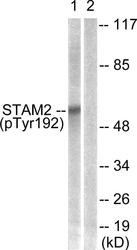 Polyclonal Rabbit anti-Human STAM2 Antibody (phospho-Tyr192, WB)
