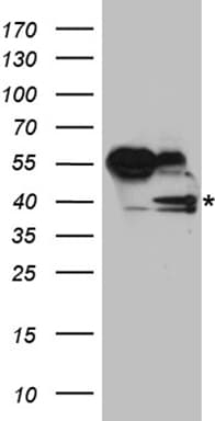 Polyclonal Rabbit anti-Human RFC3 Antibody (WB)