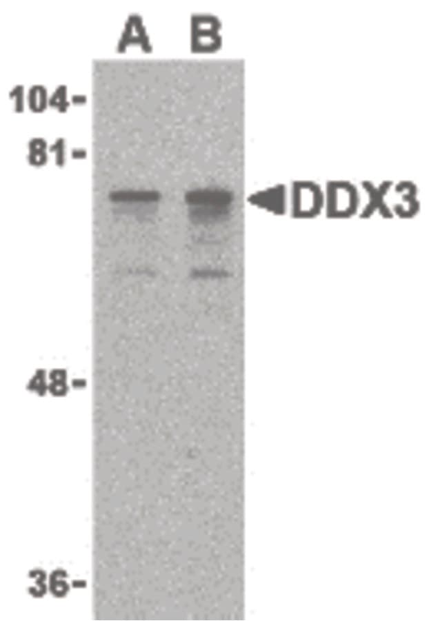IHC-plus™ DDX3 / DDX3X Antibody