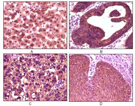 Monoclonal Mouse anti-Human CSNK1E / CK1 Epsilon Antibody (clone 3C10F7, IHC, WB)