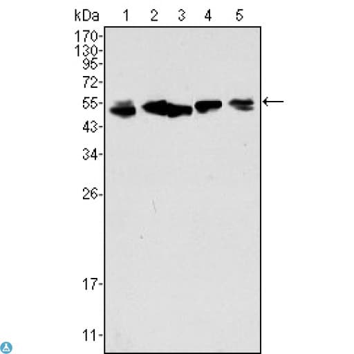 KRT8 / CK8 / Cytokeratin 8 Antibody