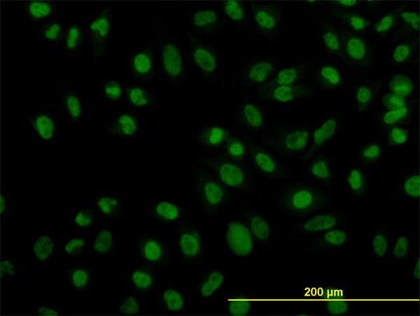 ZNF143 / STAF Antibody (clone 2B4)