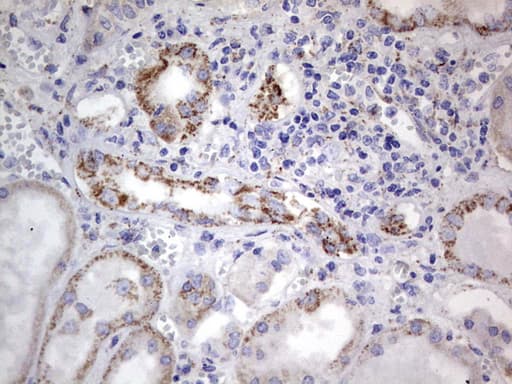 POSTN / Periostin Antibody (aa538-781, clone OTI2F7)