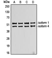 TP53 / p53 Antibody (C-Terminus)