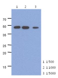 ENO2 / NSE Antibody (clone AT17D10)