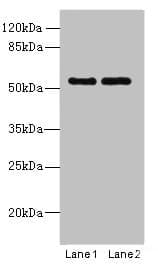 Polyclonal Rabbit anti-Human TRIM17 / RNF16 Antibody (IHC, WB)