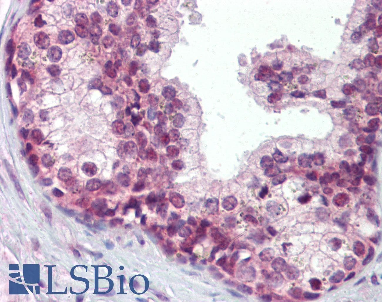 IHC-plus™ ELF4 / MEF Antibody (aa211-237)