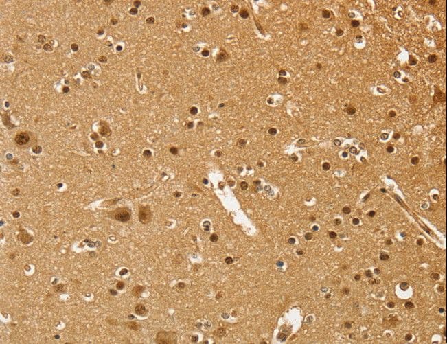 Polyclonal Rabbit anti-Human PSMC1 Antibody (IHC, WB)