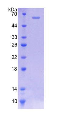 Rat SLC38A1 / NaT2 Protein (Recombinant His-GST)