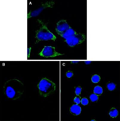 RTN3 / Reticulon 3 Antibody (clone 1E+11)