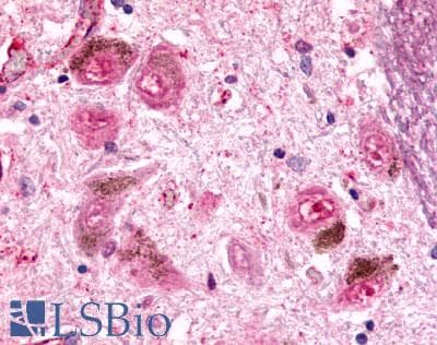 PathPlus™ Polyclonal Rabbit anti-Human ADGRE2 / EMR2 Antibody (N-Terminus, IHC)