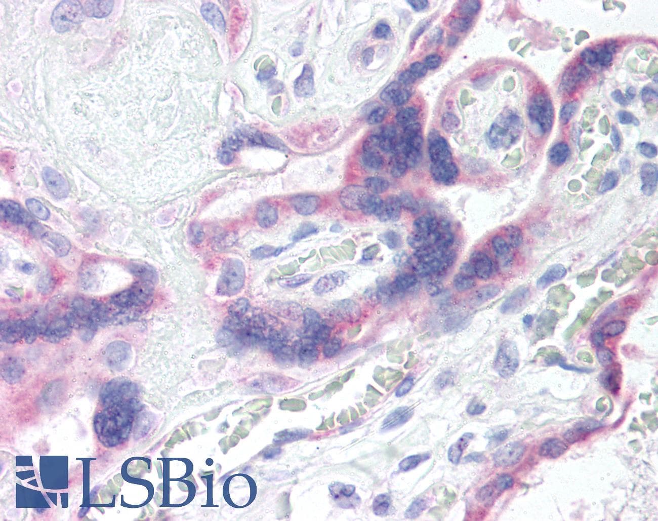 IHC-plus™ Polyclonal Rabbit anti-Human GRK5 Antibody (IHC, WB)
